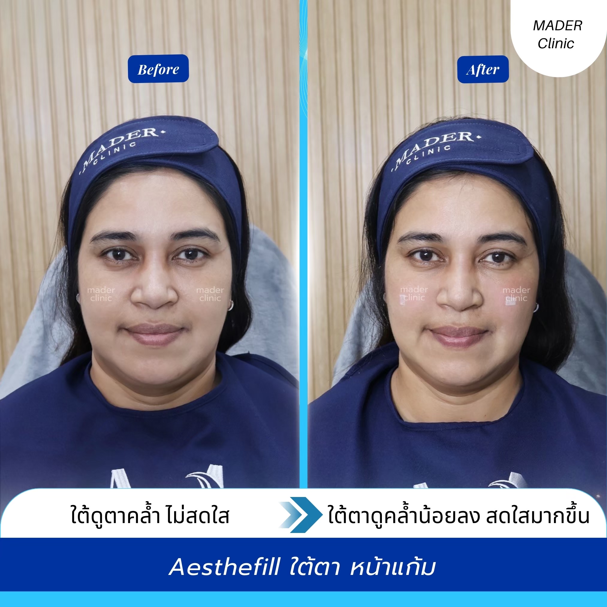 รีวิว MADER Clinic