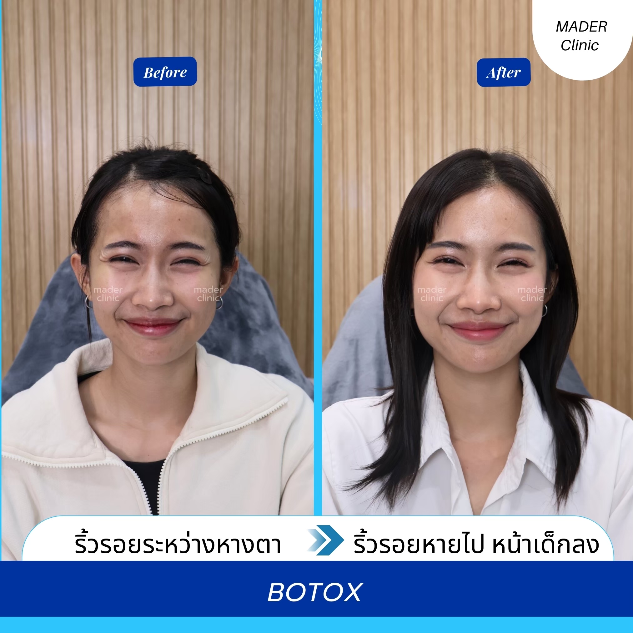 รีวิว MADER Clinic
