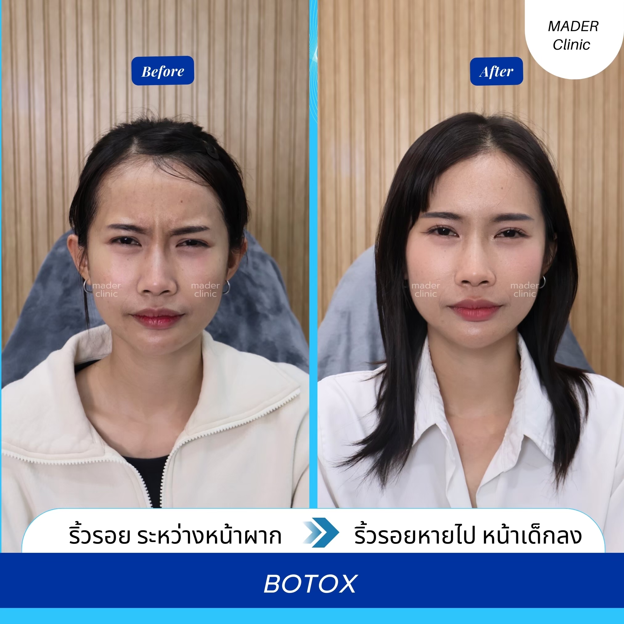 รีวิว MADER Clinic