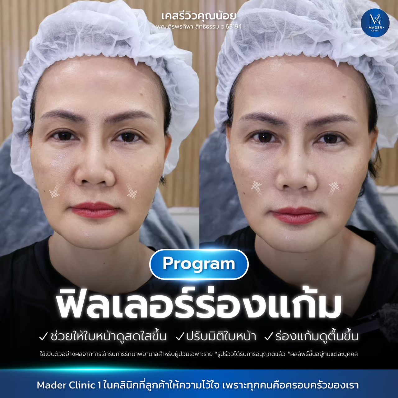 รีวิว MADER Clinic