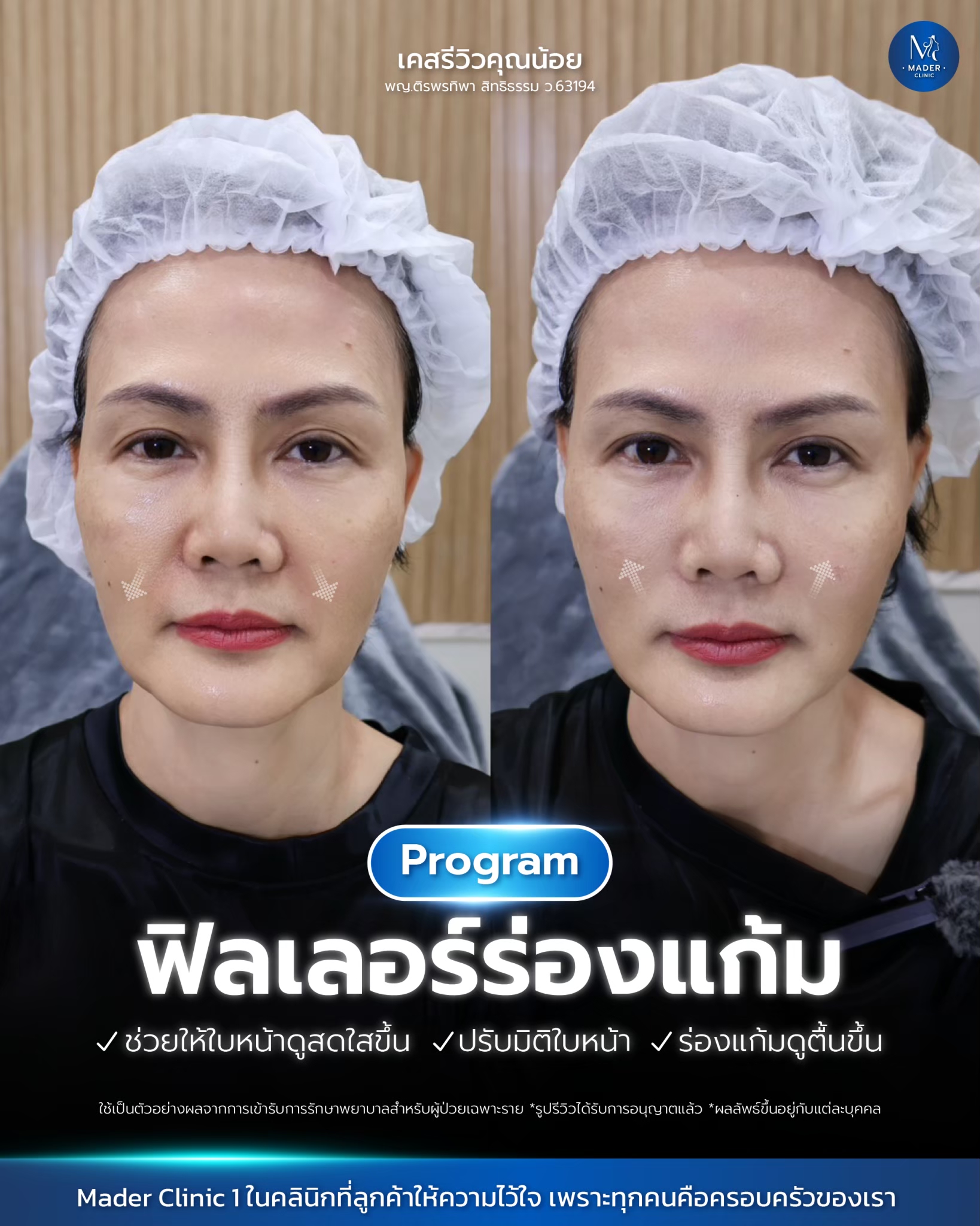รีวิว MADER Clinic