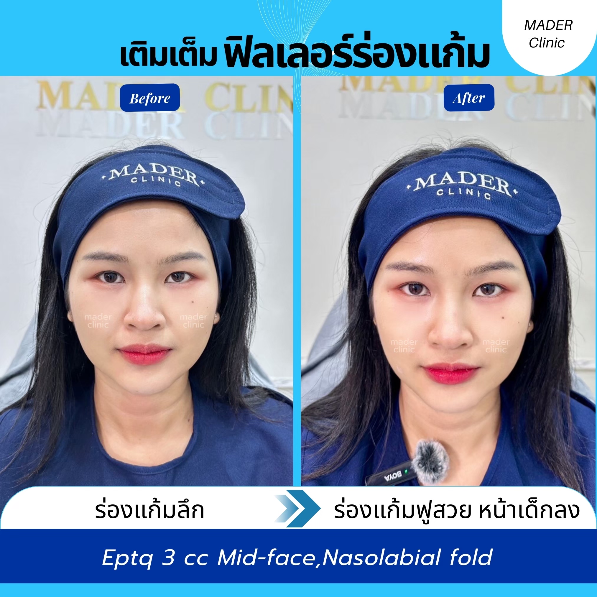 รีวิว MADER Clinic