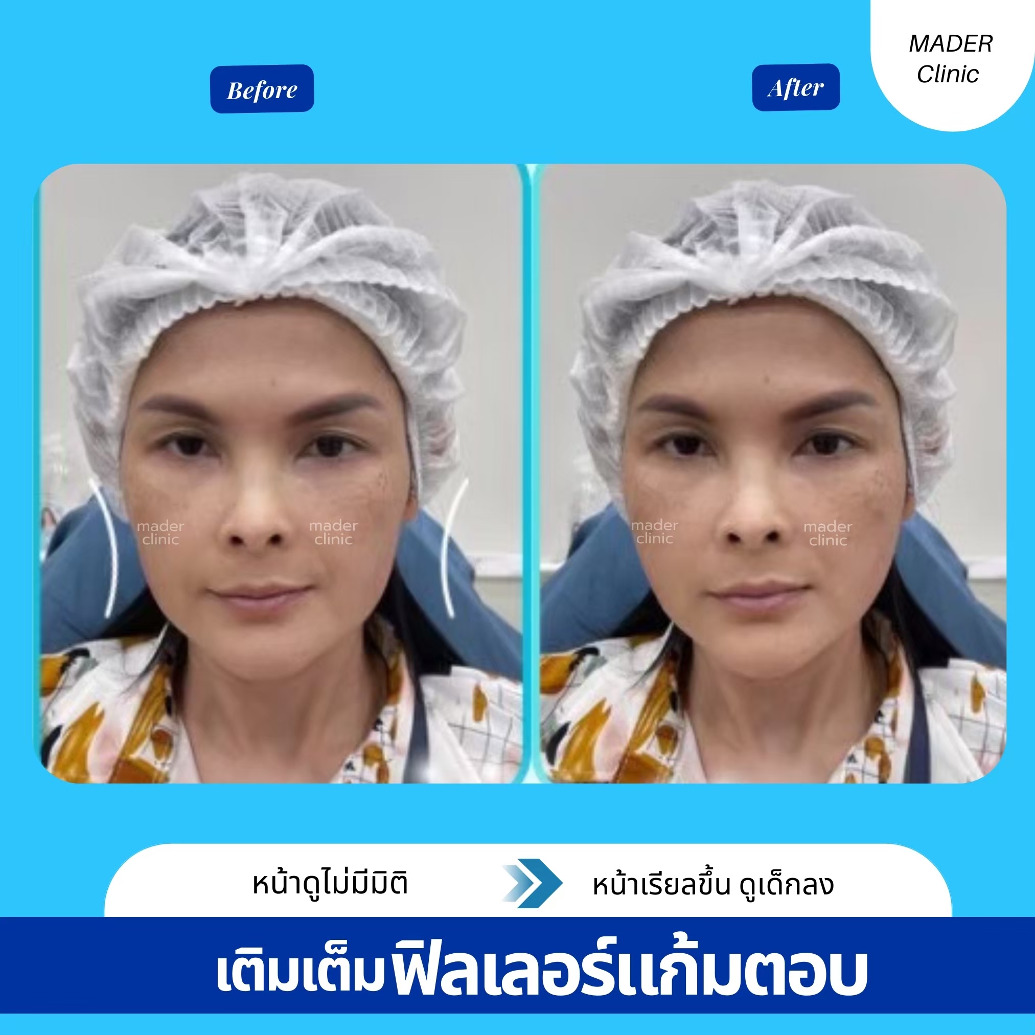รีวิว MADER Clinic