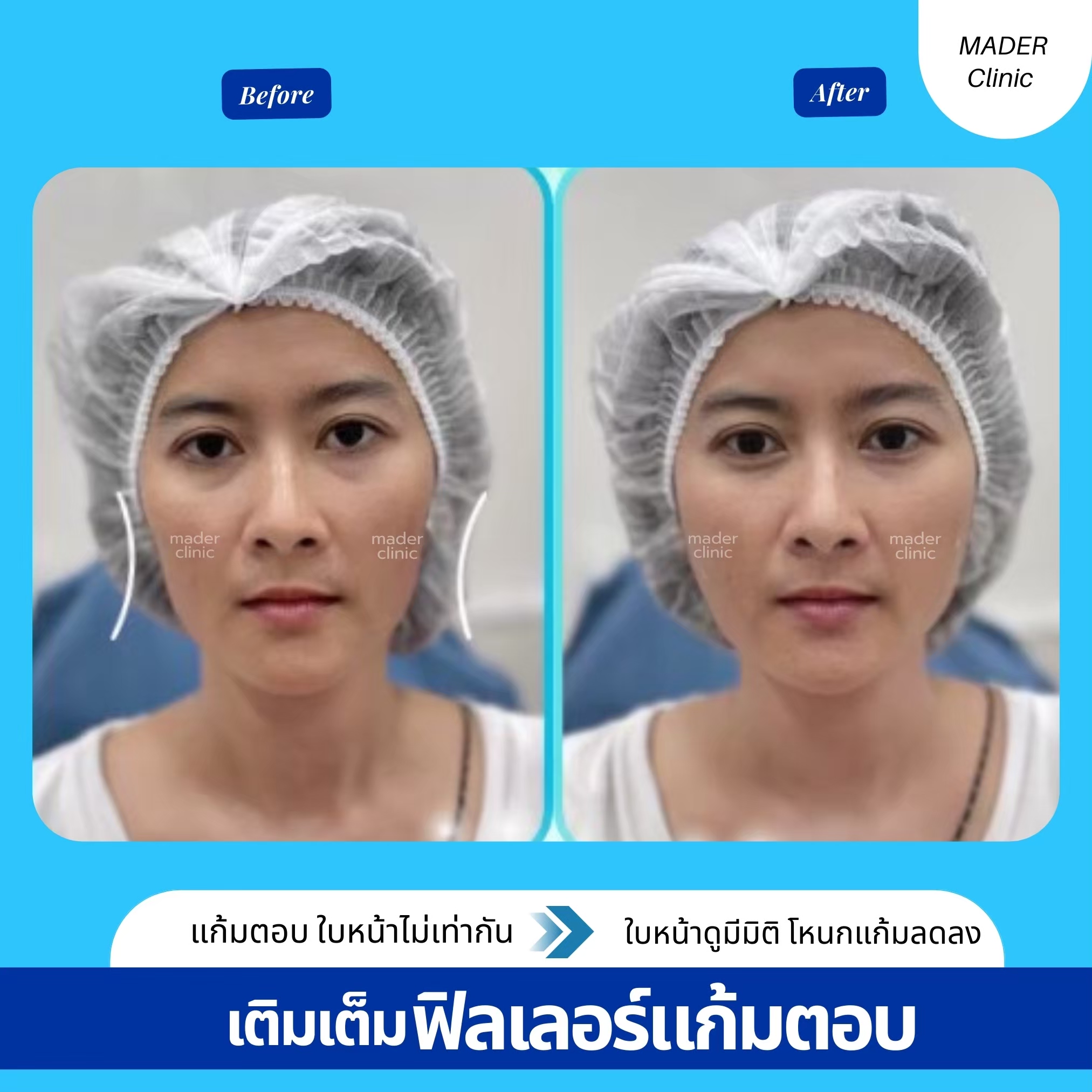 รีวิว MADER Clinic