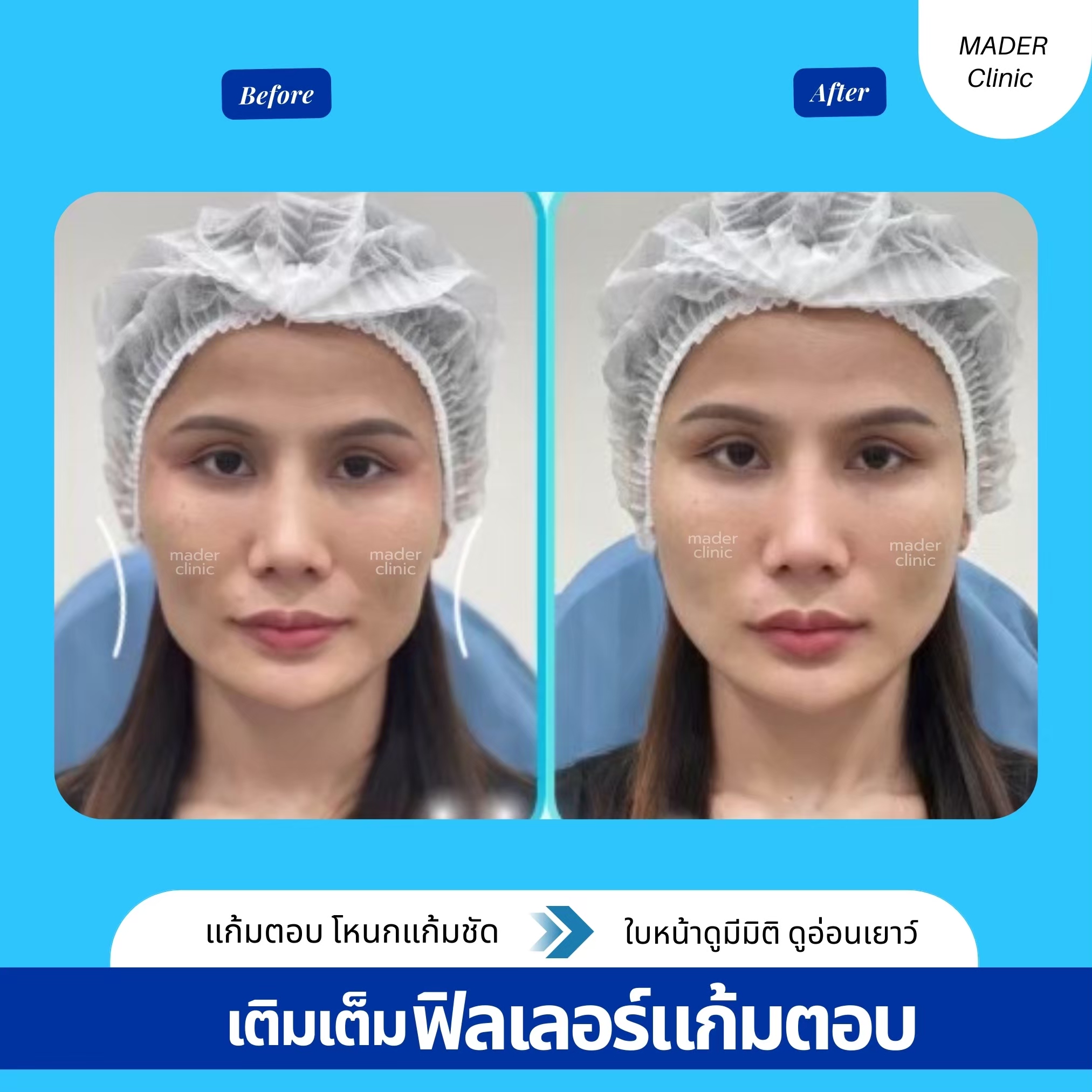รีวิว MADER Clinic
