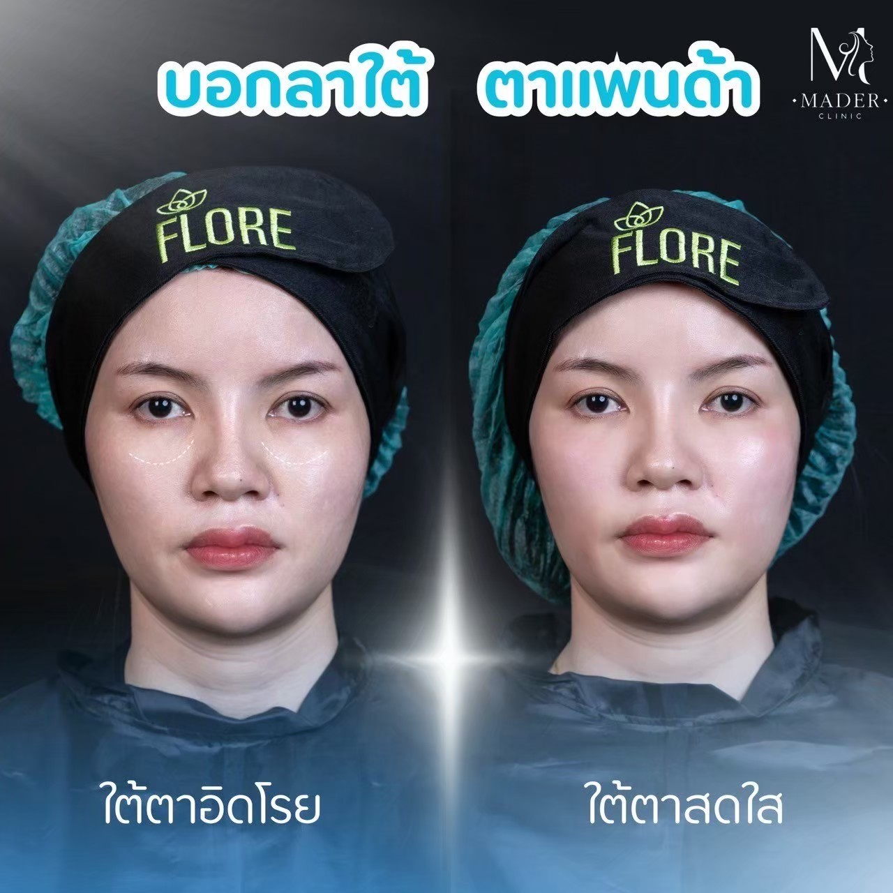 รีวิว MADER Clinic