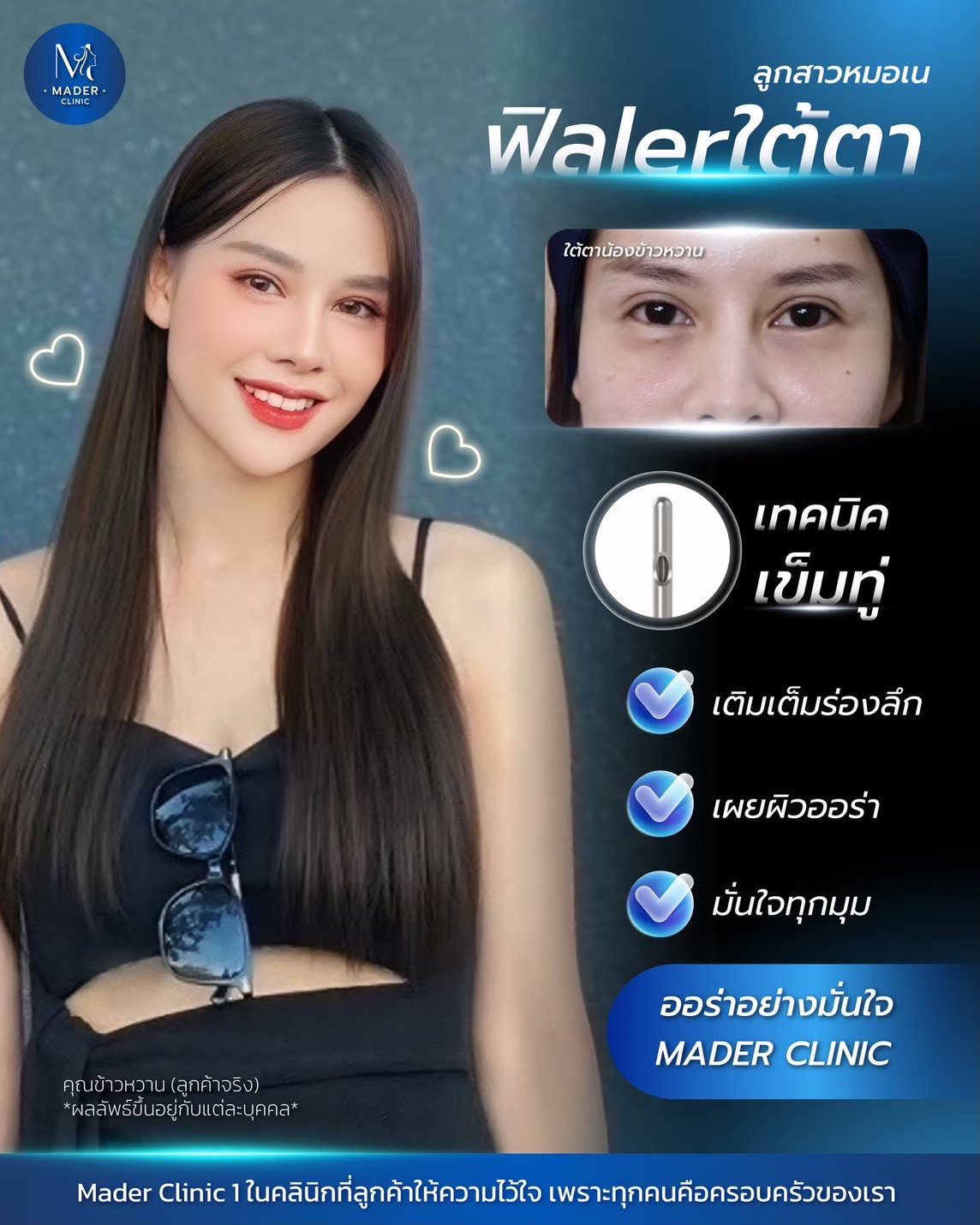รีวิว MADER Clinic