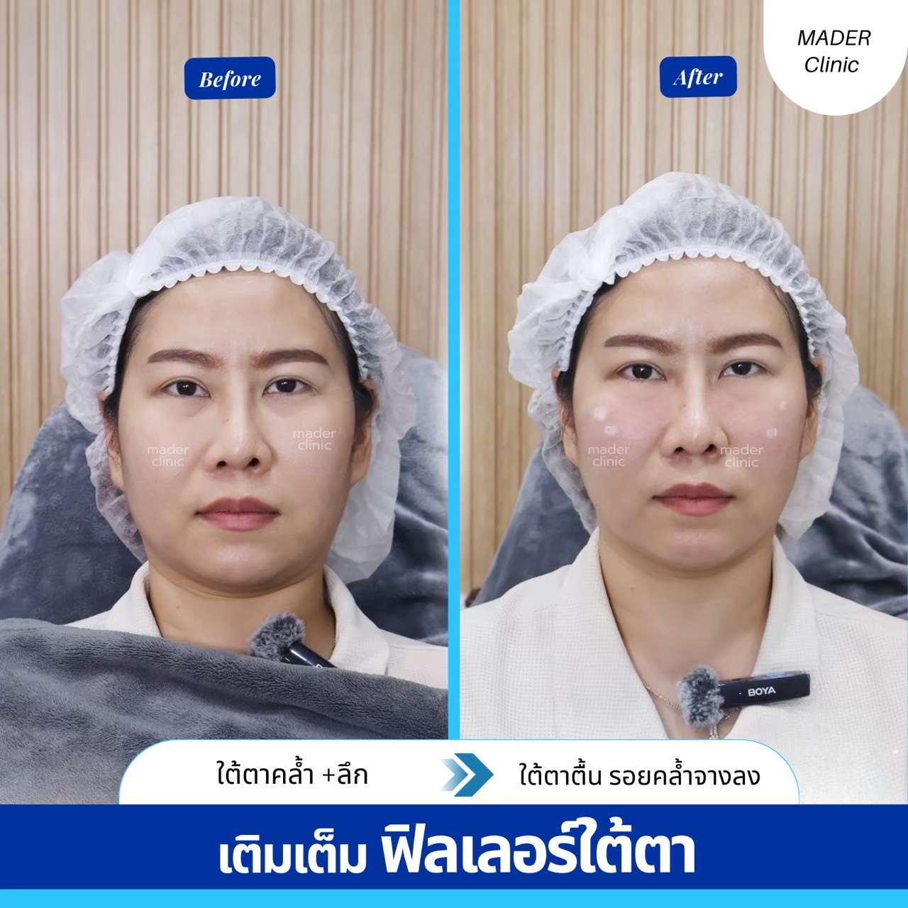 รีวิว MADER Clinic