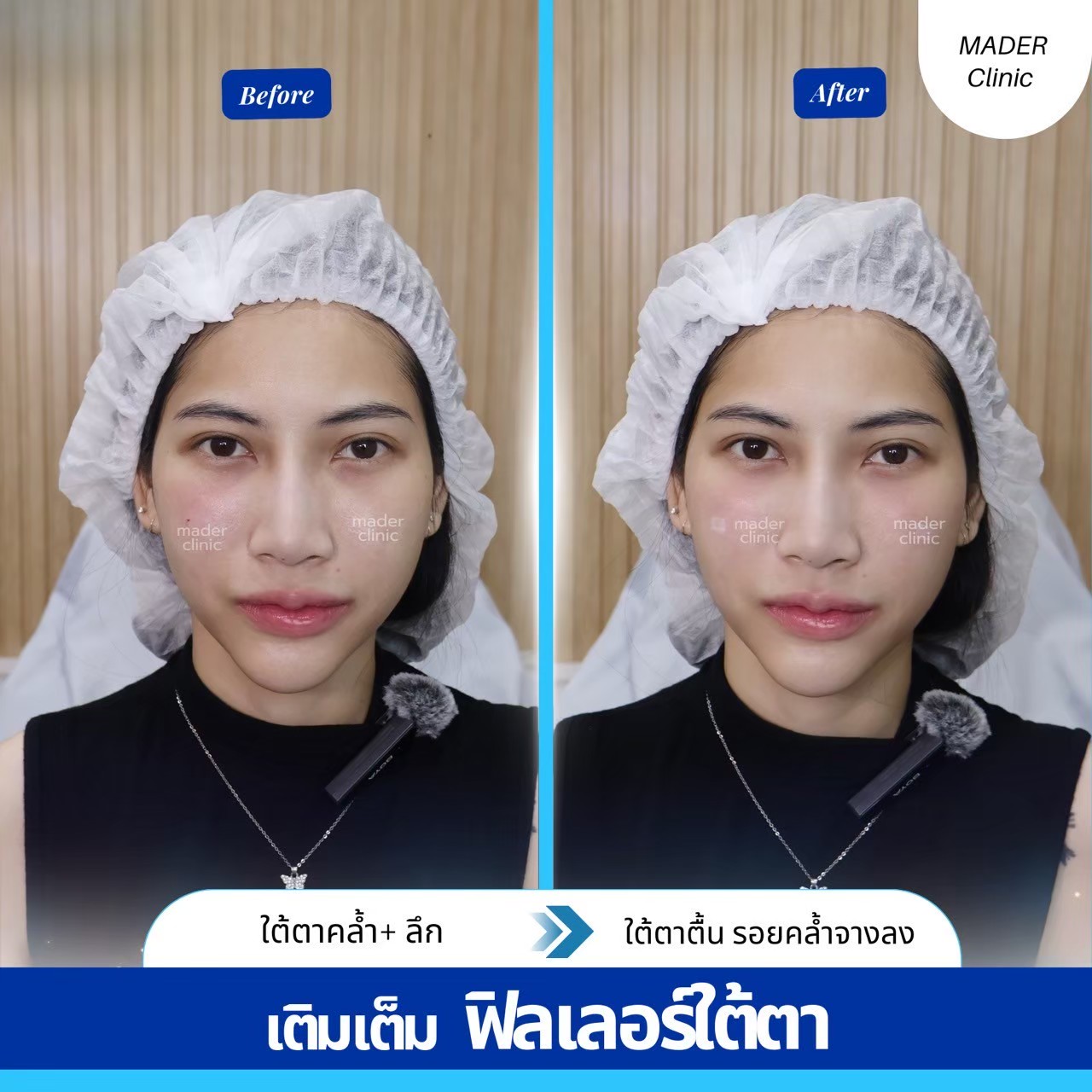 รีวิว MADER Clinic