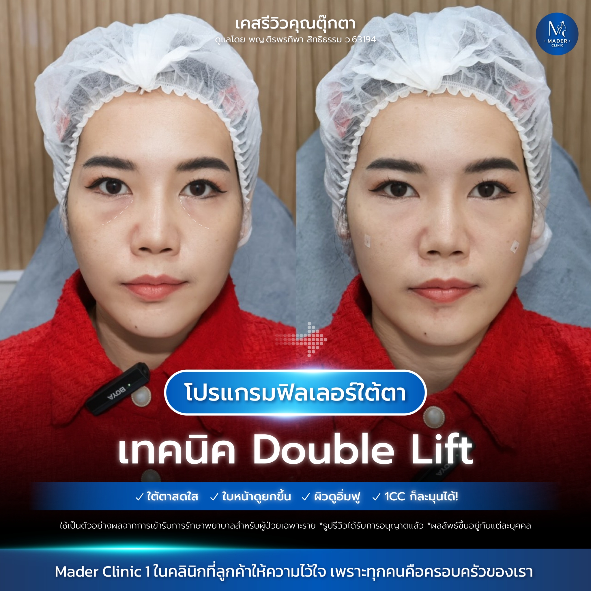 รีวิว MADER Clinic