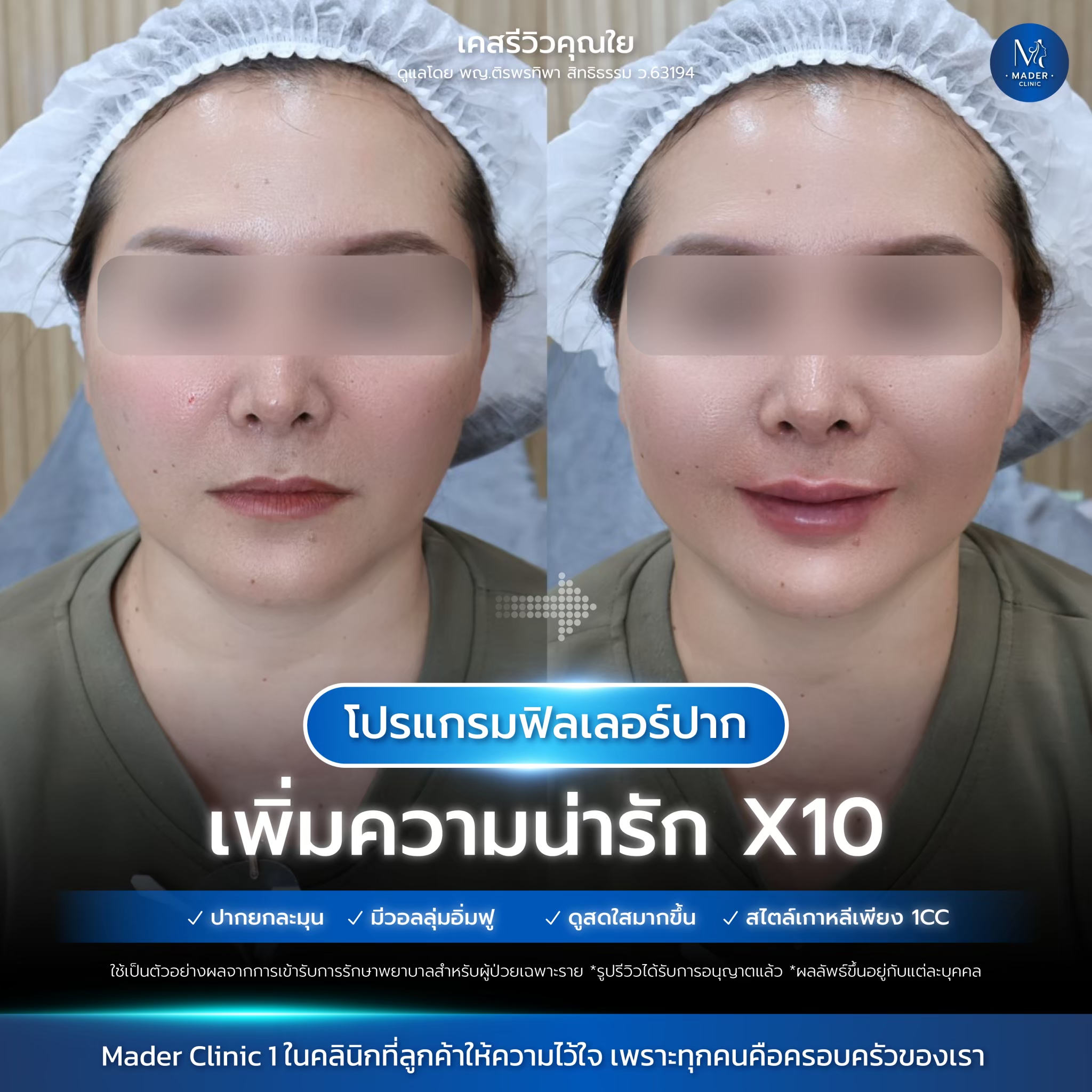 รีวิว MADER Clinic