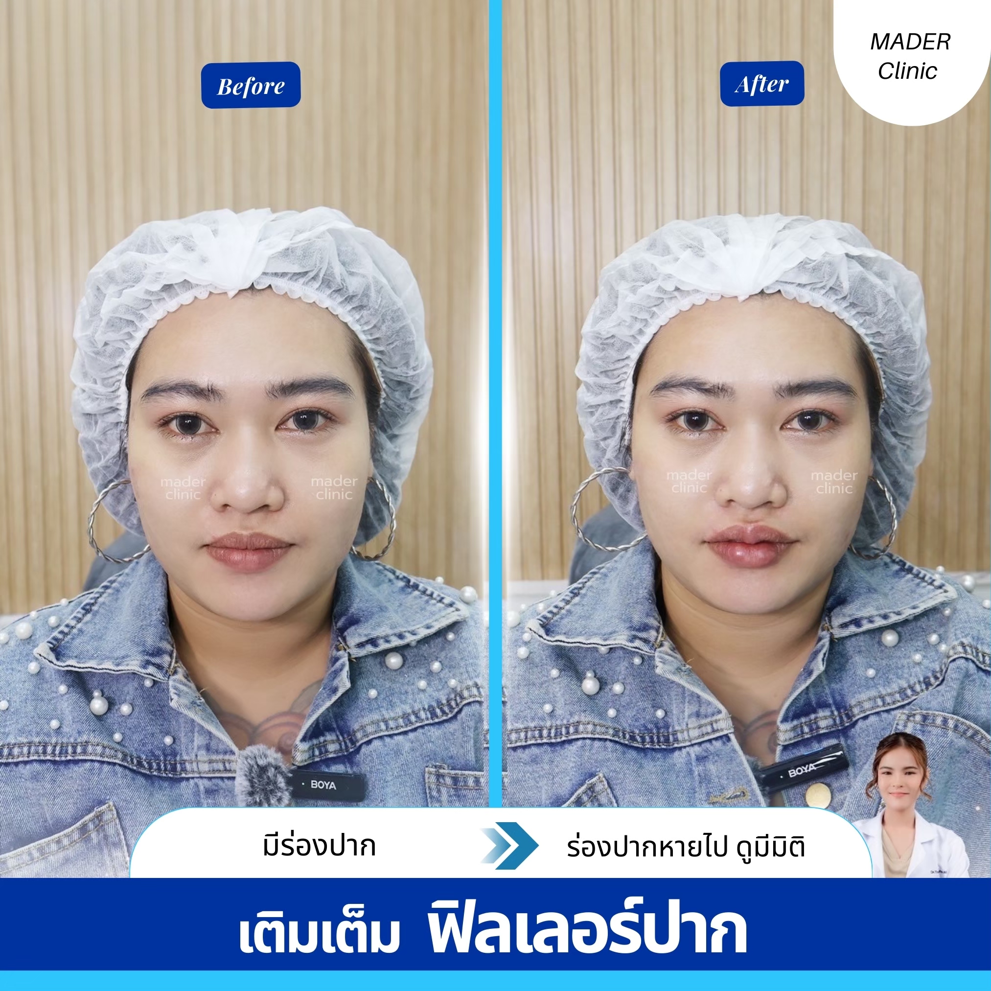 รีวิว MADER Clinic
