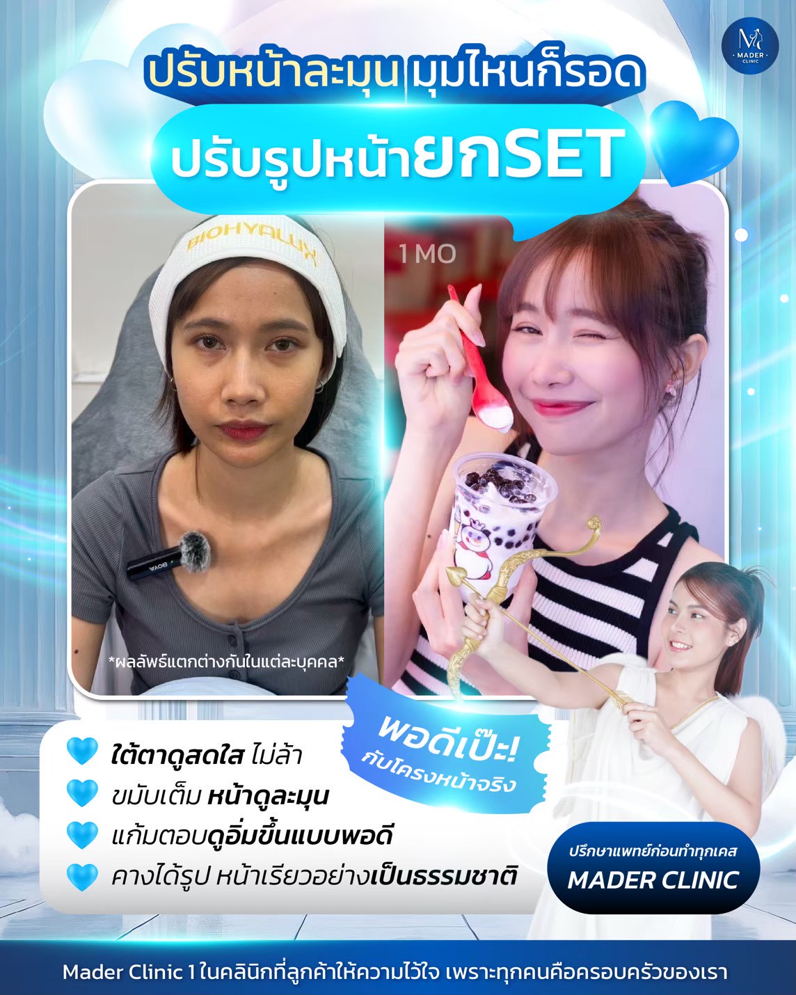 รีวิว MADER Clinic