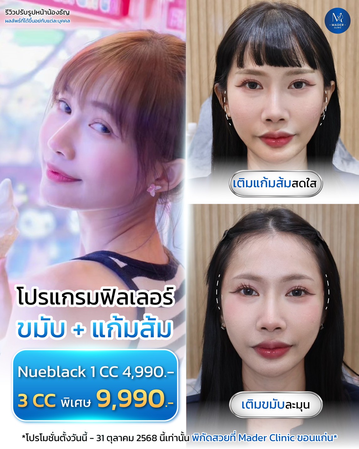 รีวิว MADER Clinic