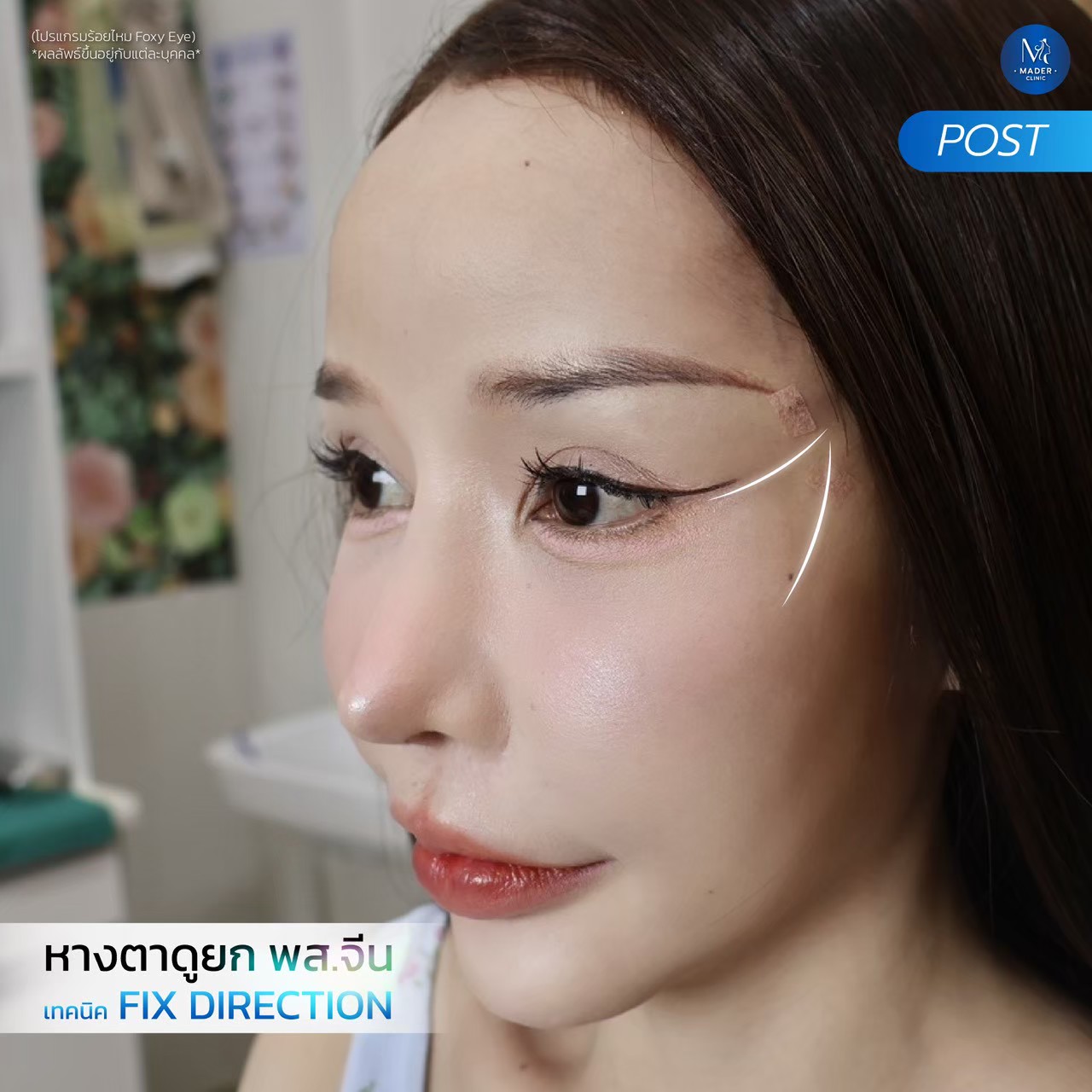 รีวิว MADER Clinic