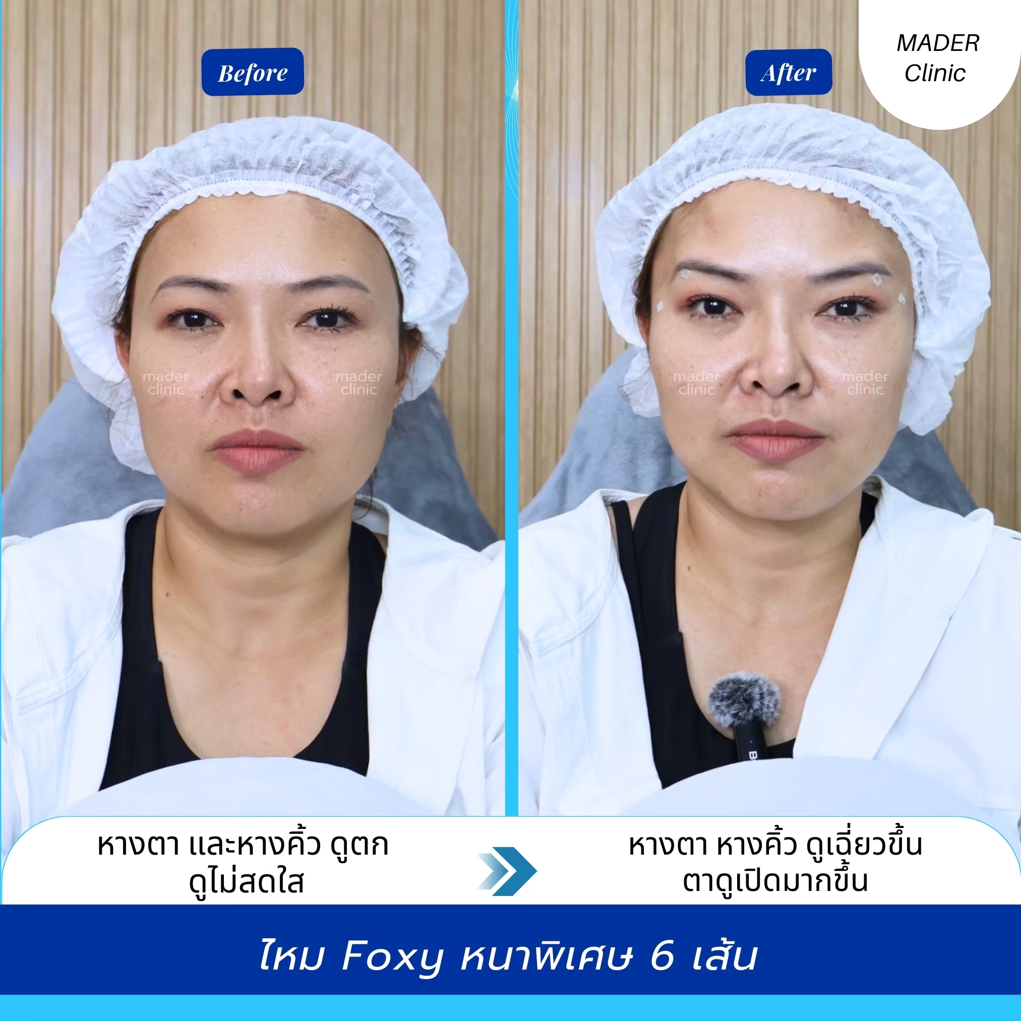 รีวิว MADER Clinic