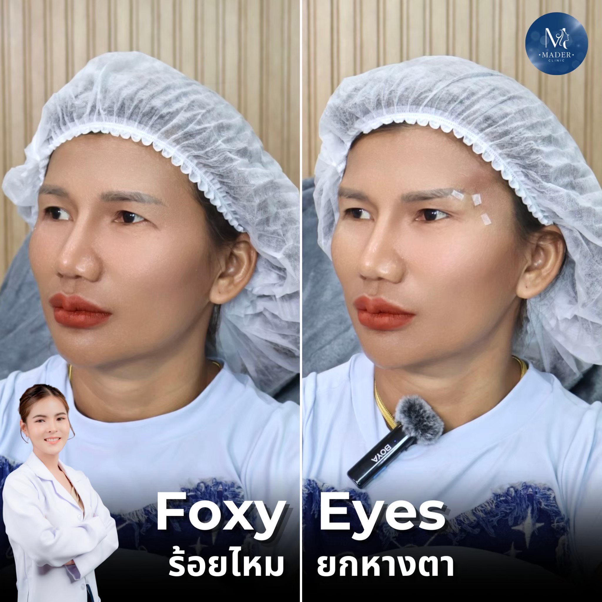 รีวิว MADER Clinic