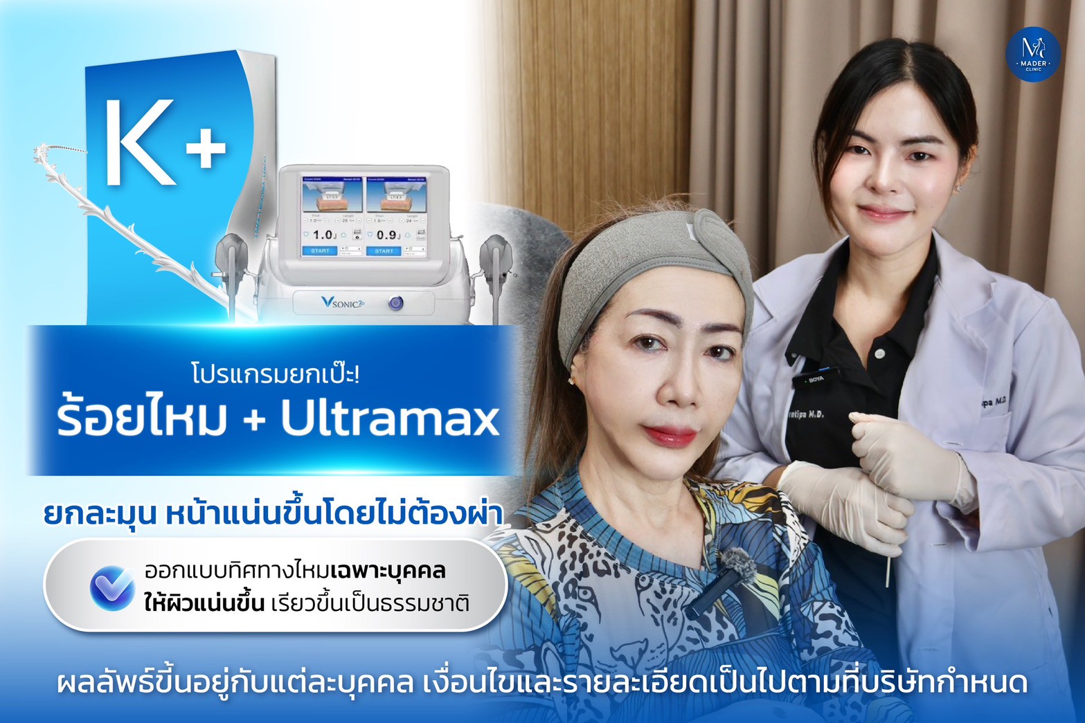 รีวิว HIFU