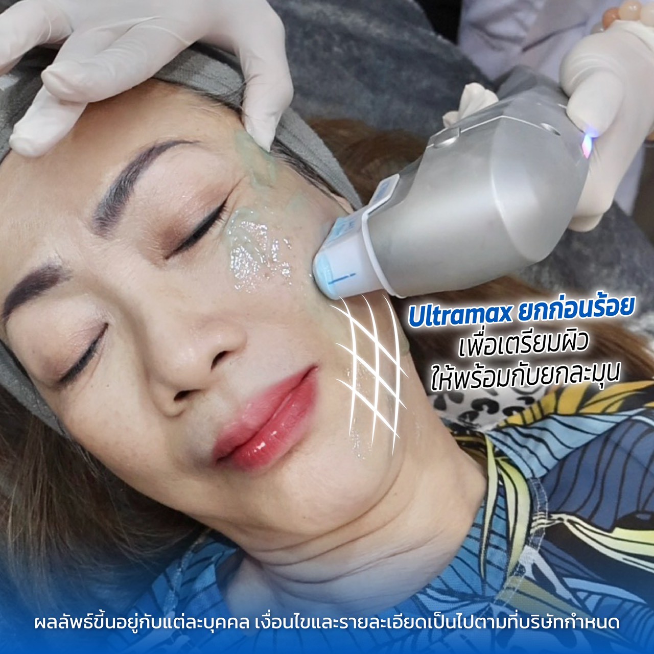 รีวิว MADER Clinic