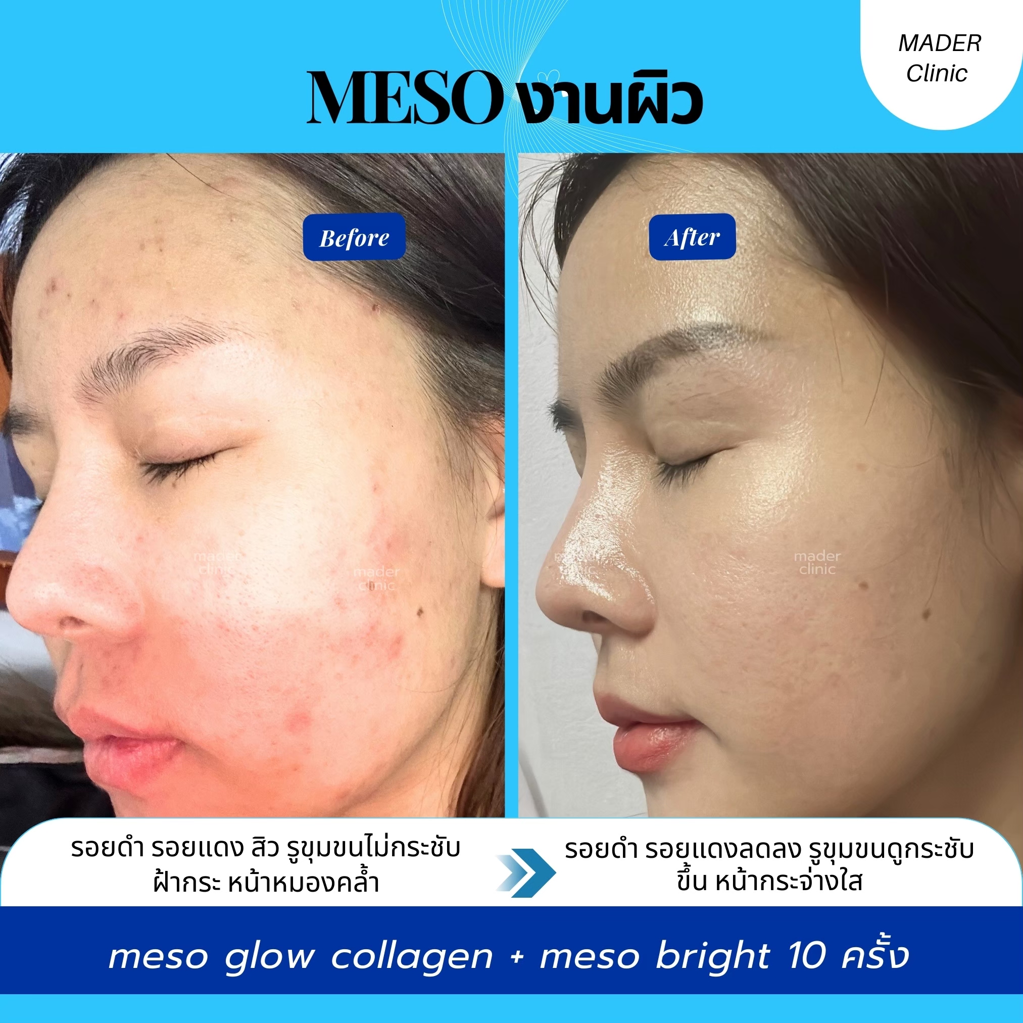 รีวิว MADER Clinic