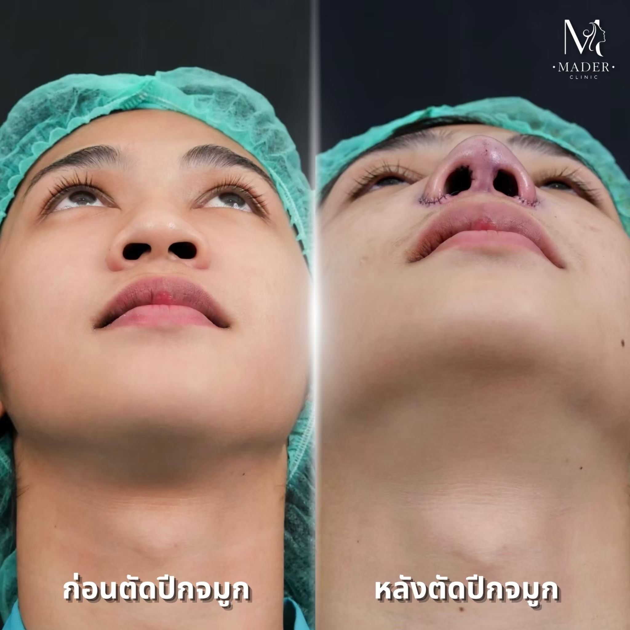 รีวิว MADER Clinic
