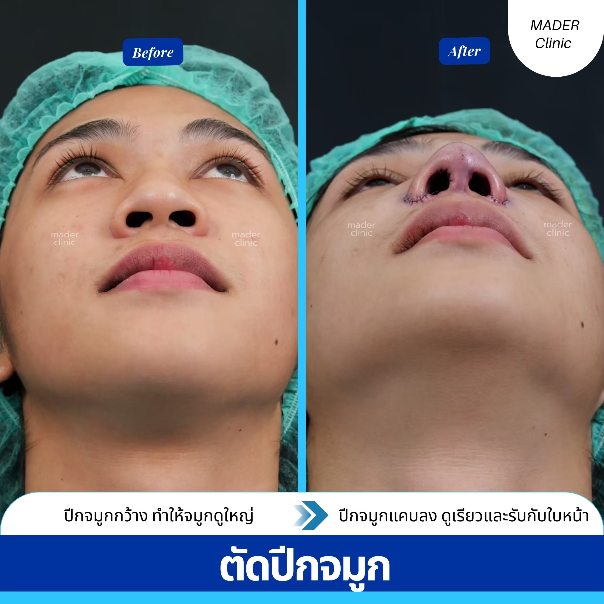 รีวิว MADER Clinic