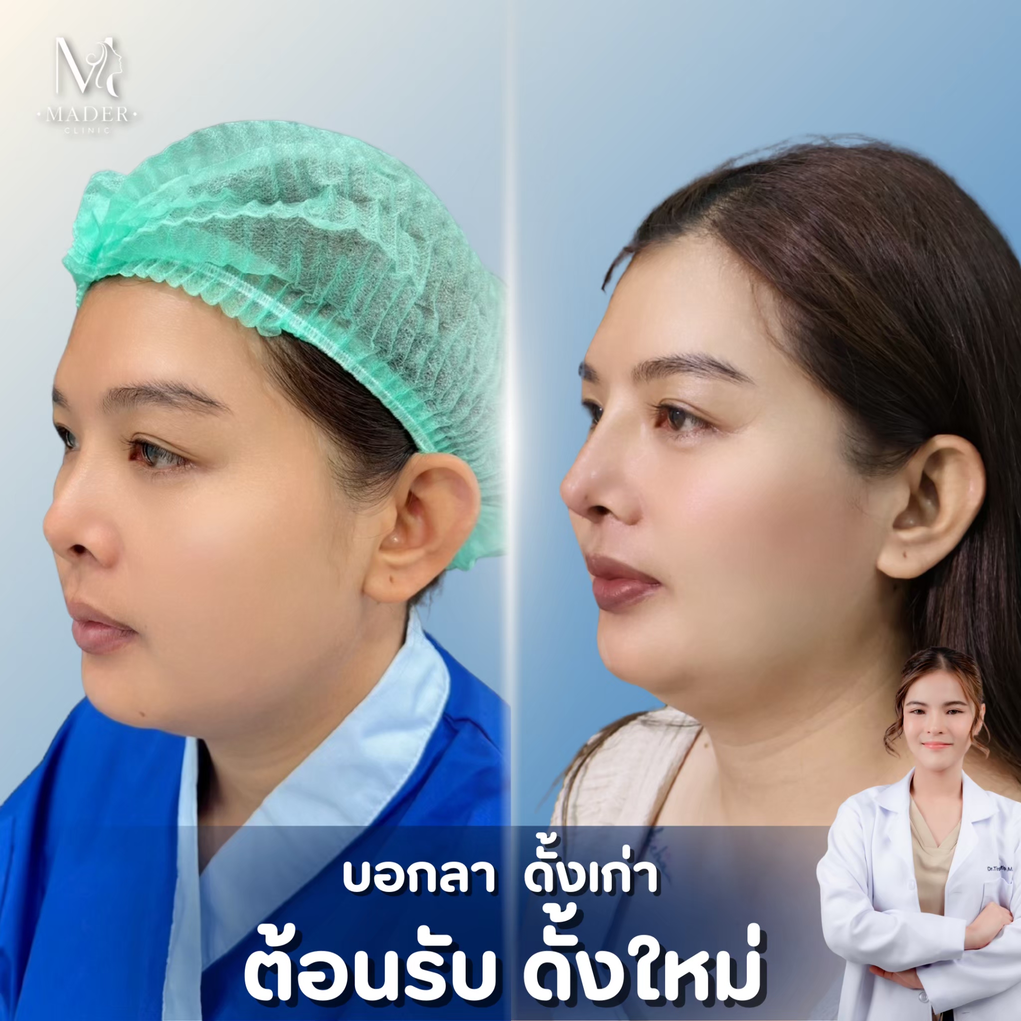 รีวิว MADER Clinic
