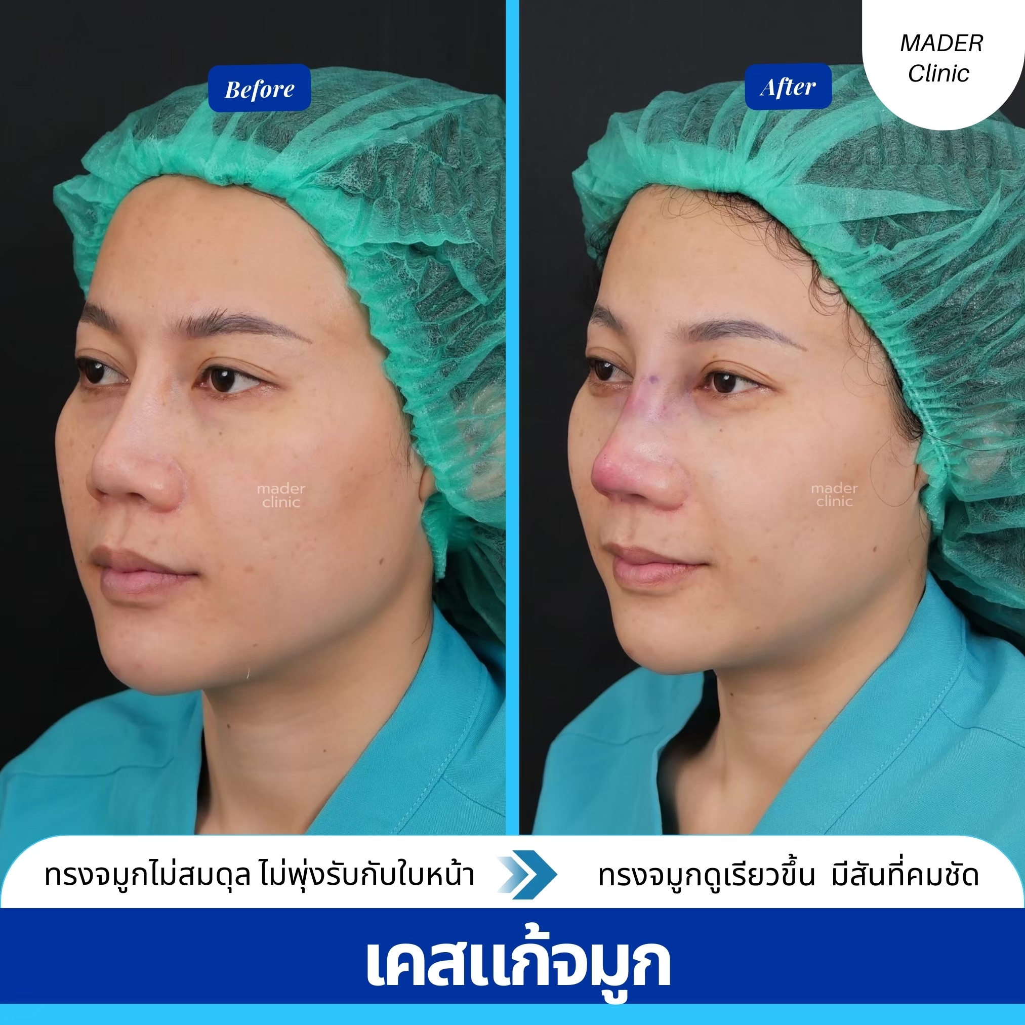 รีวิว MADER Clinic
