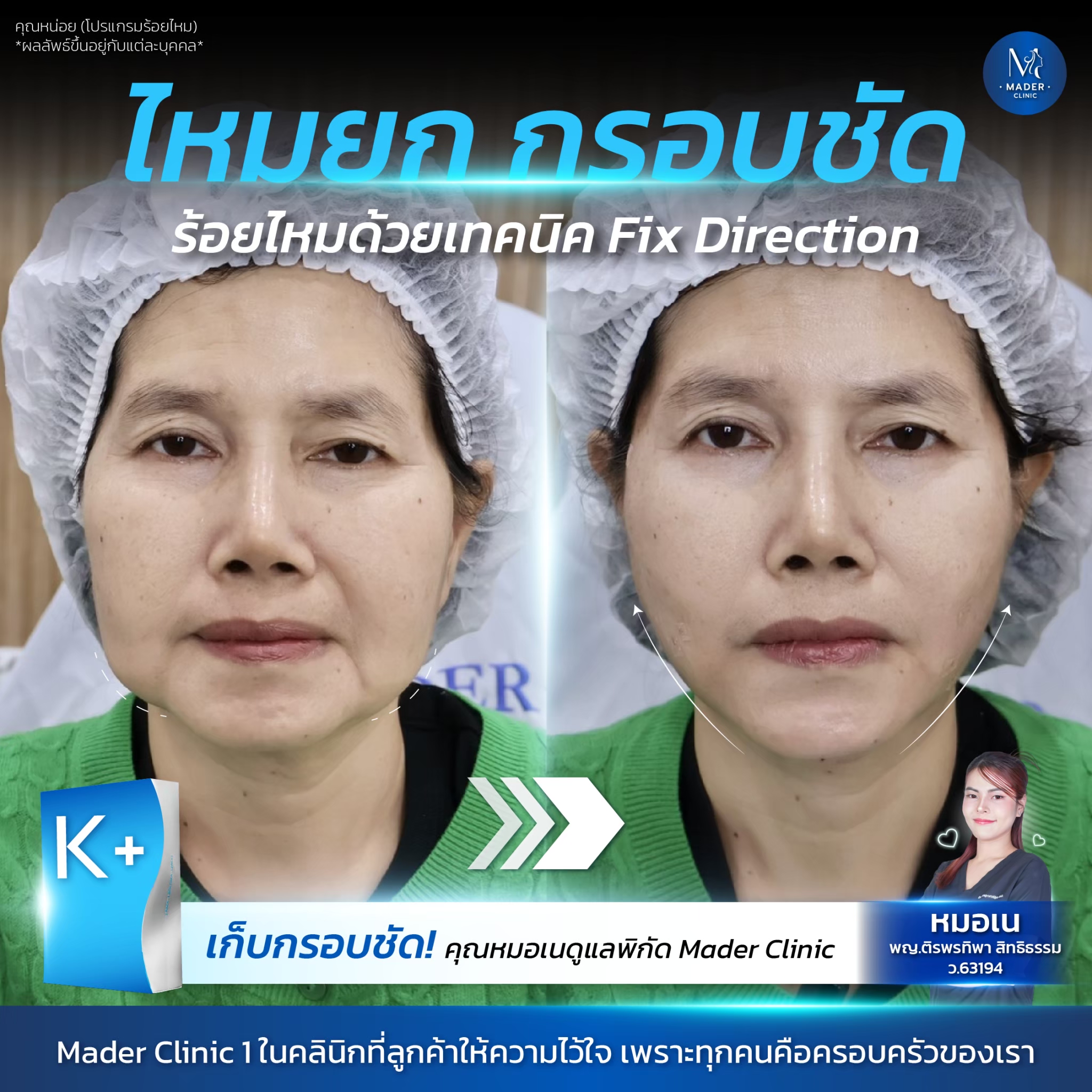 รีวิว MADER Clinic